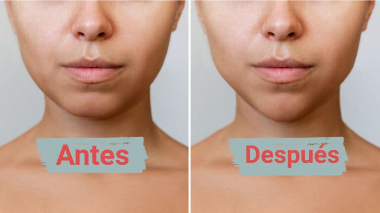 «Mewing»: ¿funciona esta técnica viral para definir el rostro?