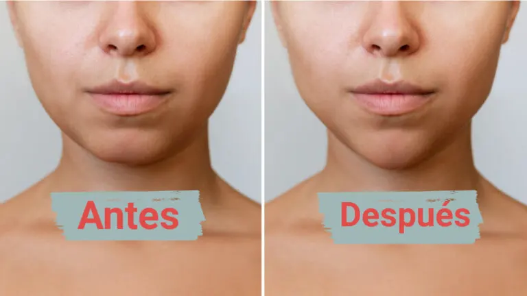 «Mewing»: ¿funciona esta técnica viral para definir el rostro?