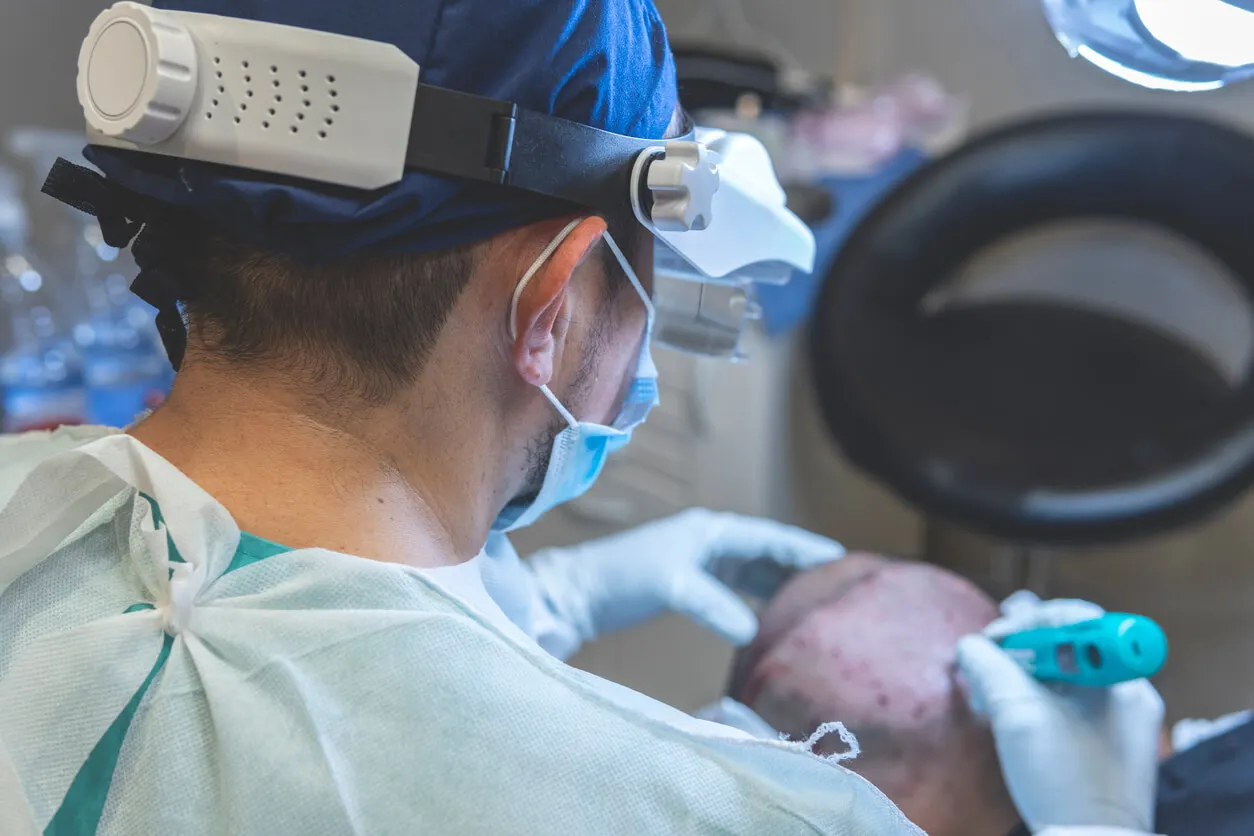 Clínica de implante capilar em Türkiye.