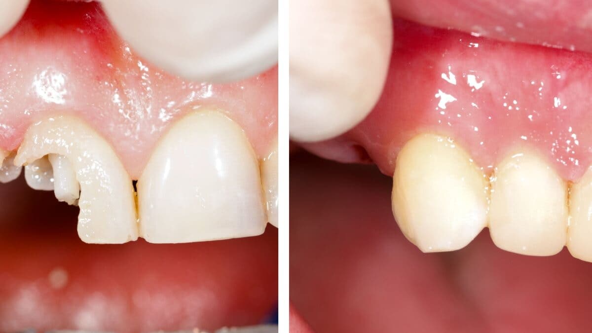 Empaste dental.