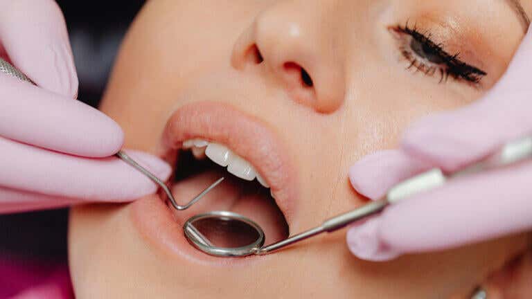 Tipos de manchas en los dientes, cómo identificarlas y eliminarlas