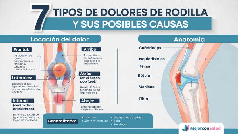 Perdida De Sensibilidad En La Rodilla