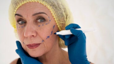 Qué es el «lifting deep plane», la técnica más avanzada y menos invasiva para rejuvenecer el rostro