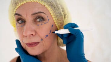 Qué es el «lifting deep plane», la técnica más avanzada y menos invasiva para rejuvenecer el rostro