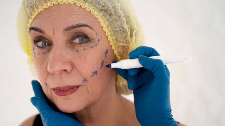 Qué es el «lifting deep plane», la técnica más avanzada y menos invasiva para rejuvenecer el rostro