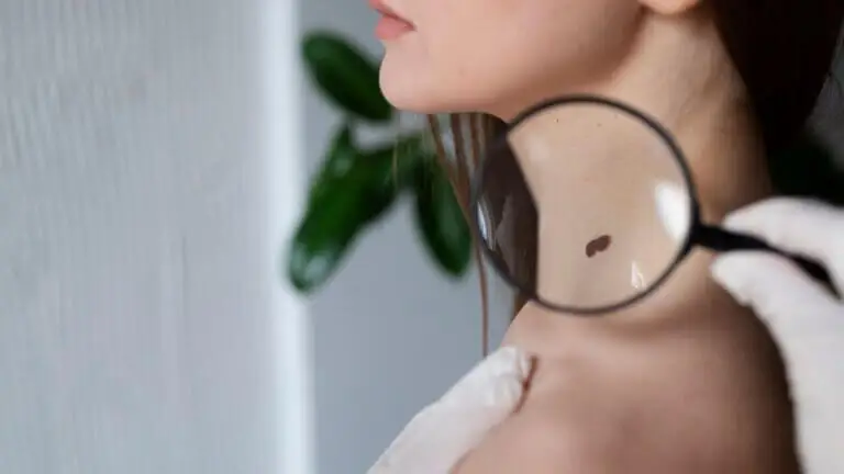 ¿Por qué aparecen las verrugas en el cuello y cómo eliminarlas?