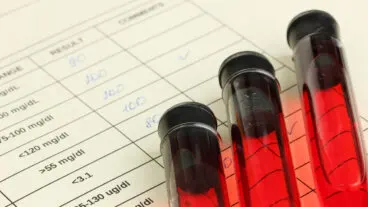 Qué indica la hemoglobina corpuscular media en los análisis