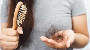 Vitaminas y minerales para evitar la caída del cabello