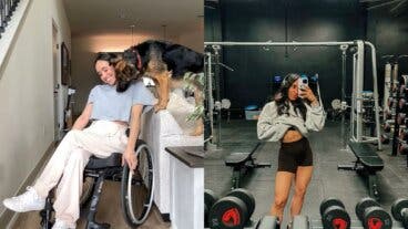 Parálisis por babesiosis: el diagnóstico que recibió una influencer tras ser picada por una garrapata