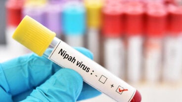 Qué se sabe sobre Nipah, el virus que ha encendido las alertas sanitarias