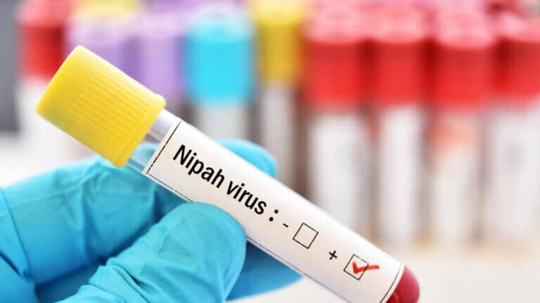 Qué se sabe sobre Nipah, el virus que ha encendido las alertas sanitarias