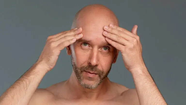 Así debes cuidar tu calva o cabeza rapada, según los dermatólogos