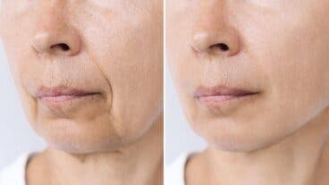 Inflammaging: el envejecimiento inflamatorio que no viene solo con la edad y 5 claves para frenarlo