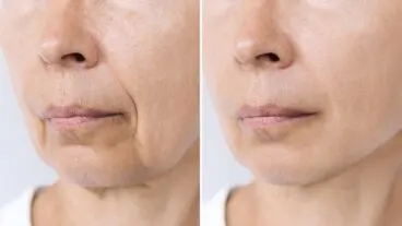 Inflammaging: el envejecimiento inflamatorio que no viene solo con la edad y 5 claves para frenarlo