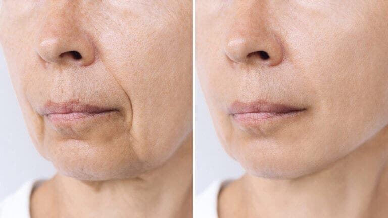 Inflammaging: el envejecimiento inflamatorio que no viene solo con la edad y 5 claves para frenarlo