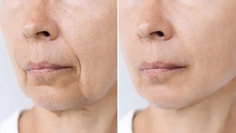 Inflammaging: el envejecimiento inflamatorio que no viene solo con la edad y 5 claves para frenarlo