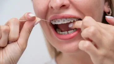Cepillo interdental vs hilo dental: cómo elegir el mejor para ti