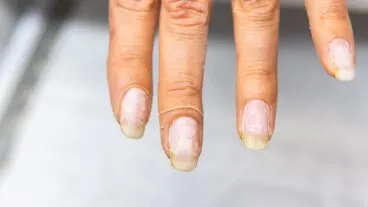 Los efectos ocultos de abusar de las manicuras semipermanentes y de gel