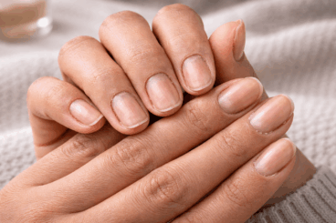 ¿Por qué la piel de tus manos se ve más vieja de lo que es? 7 errores de cuidado que debes evitar