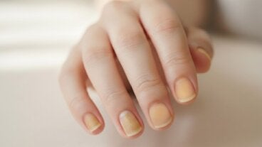 ¿Por qué las uñas se ponen amarillas? Qué significa y cómo recuperar el tono