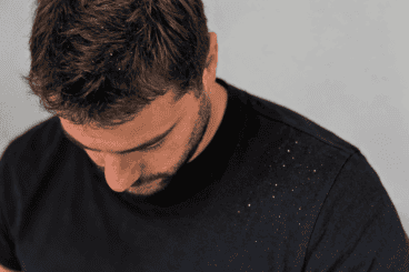 ¿Caspa hasta en los hombros? 5 formas realistas de controlarla mejor