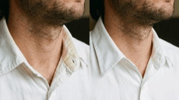 Cómo eliminar manchas de sudor amarillentas en el cuello de las camisas en 5 pasos