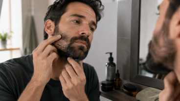 Escamas en la barba: 6 cuidados para la piel que pueden ayudar