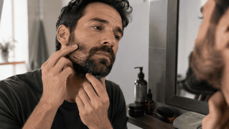 Escamas en la barba: 6 cuidados para la piel que pueden ayudar