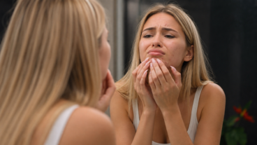 7 trucos para disimular un grano antes de un evento sin empeorarlo