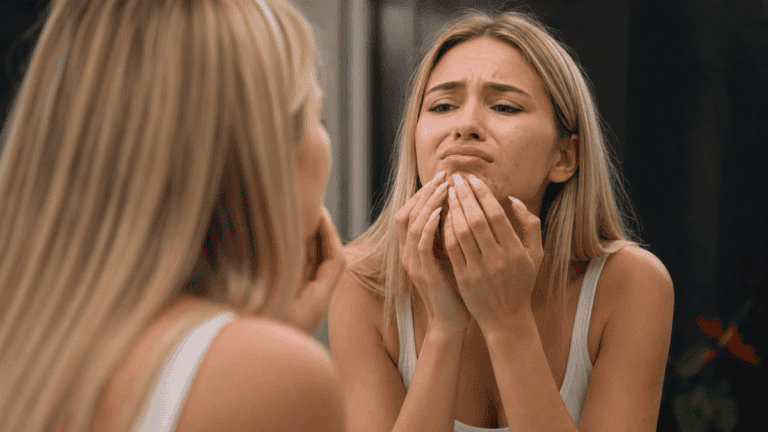7 trucos para disimular un grano antes de un evento sin empeorarlo